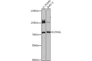 Western blot analysis of extracts of various cell lines, using CPXM1 antibody (ABIN7266082) at 1:1000 dilution. (CPXM1 antibody)
