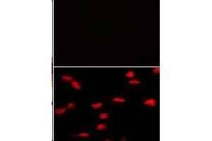 (TOP)Negative control of hela cells without PE-conjugated goat anti-mouse lgG (whole molecule). (SETD8 antibody  (N-Term))