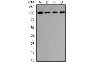 Western blot analysis of USP25 expression in SKOV3 (A), PC12 (B), mouse brain (C), mouse liver (D) whole cell lysates. (USP25 antibody)