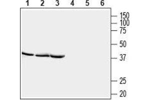 Western blot analysis of rat brain lysate (lanes 1 and 4), mouse brain lysate (lanes 2 and 5) and rat skeletal muscle lysate (lanes 3 and 6): - 1-3. (STOML2 antibody  (Intracellular))