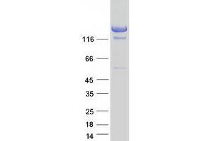 Validation with Western Blot (A2ML1 Protein (Myc-DYKDDDDK Tag))