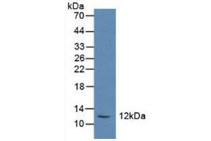Figure. (Somatostatin antibody  (AA 27-116))