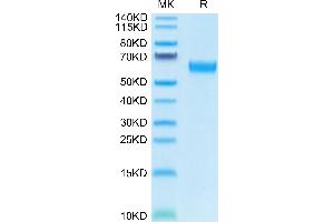 Human CD47 on Tris-Bis PAGE under reduced condition. (CD47 Protein (CD47) (AA 19-139) (Fc Tag))