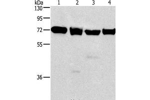 Western Blot analysis of 231, 293T, Raji and hela cell using IL2RB Polyclonal Antibody at dilution of 1:325 (IL2 Receptor beta antibody)
