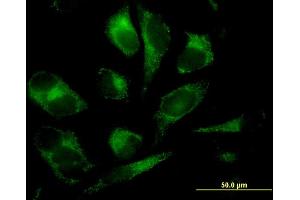 Immunofluorescence of monoclonal antibody to GSTM2 on HeLa cell. (GSTM2 antibody  (AA 90-189))