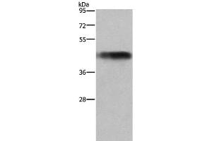 Western Blot analysis of Human fetal liver tissue using GALT Polyclonal Antibody at dilution of 1:300 (GALT antibody)