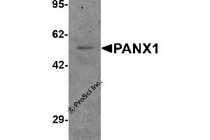 Western Blotting (WB) image for anti-Pannexin 1 (PANX1) (N-Term) antibody (ABIN1077400) (PANX1 antibody  (N-Term))