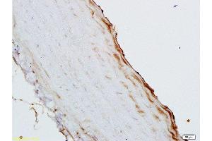 Immunohistochemistry (Paraffin-embedded Sections) (IHC (p)) image for anti-Colony Stimulating Factor 2 (Granulocyte-Macrophage) (CSF2) (AA 71-141) antibody (ABIN730723)