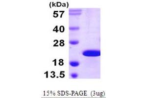 SDS-PAGE (SDS) image for Cold Inducible RNA Binding Protein (CIRBP) (AA 1-172) protein (His tag) (ABIN667435)