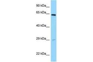 Image no. 1 for anti-Sorting Nexin 11 (SNX11) (AA 90-139) antibody (ABIN6748157) (SNX11 antibody  (AA 90-139))