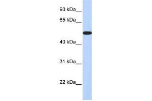 WB Suggested Anti-HOXA3 Antibody Titration:  0. (HOXA3 antibody  (Middle Region))