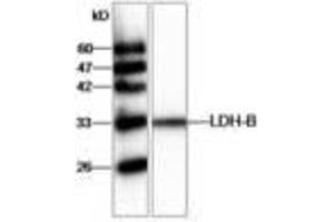 Image no. 1 for anti-Lactate Dehydrogenase B (LDHB) antibody (ABIN791437) (LDHB antibody)