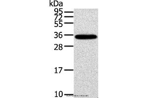 Western blot analysis of Mouse brain tissue, using KCNMB3 Polyclonal Antibody at dilution of 1:300 (KCNMB3 antibody)