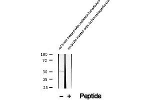Western blot analysis of extracts of rat brain treated with ischemia/reperfusion, using Phospho-CaMKII (Tyr231) Antibody.
