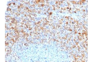 Formalin-fixed, paraffin-embedded human Spleen stained with CD40L-Monospecific Mouse Monoclonal Antibody (CD40LG/2761) (CD40 Ligand antibody  (AA 108-261))