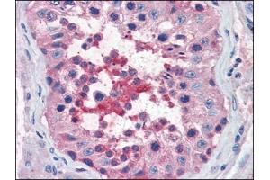 Human Testis (formalin-fixed, paraffin-embedded) stained with CXCR4at 5 µg/ml followed by biotinylated anti-goat IgG secondary antibody, alkaline phosphatase-streptavidin and chromogen. (CXCR4 antibody  (Extracellular Domain, N-Term))