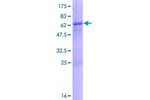 Kinesin Family Member 6 (KIF6) (AA 1-293) protein (GST tag)