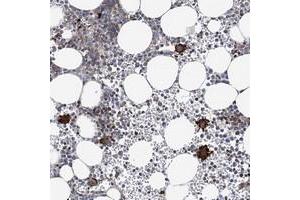 Immunohistochemical staining of human bone marrow with ARAP2 polyclonal antibody  shows strong cytoplasmic positivity in bone marrow poietic cells at 1:500-1:1000 dilution.