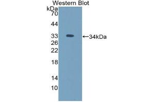 Western blot analysis of the recombinant protein. (ICAM5 antibody  (AA 164-441))