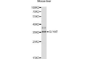Western blot analysis of extracts of mouse liver, using GLYAT antibody (ABIN6293111) at 1:3000 dilution. (GLYAT antibody)