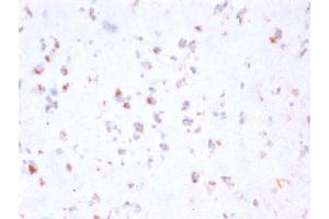 Formalin-fixed, paraffin-embedded human Cerebellum stained with FCGRT Mouse Monoclonal Antibody (FCGRT/2932). (FcRn antibody  (AA 24-215))