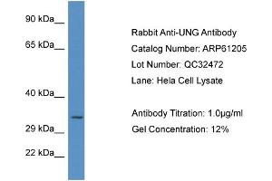 Western Blotting (WB) image for anti-Uracil-DNA Glycosylase (UNG) (C-Term) antibody (ABIN2788718)