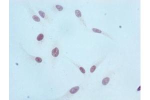 Immunocytochemistry (ICC) image for anti-Histone Cluster 1, H3a (HIST1H3A) (H3K36me) antibody (ABIN7127301)