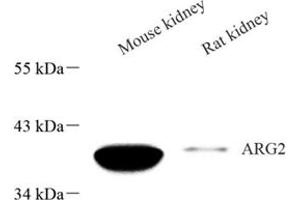 Western blot analysis of Arg2 (ABIN7073115),at dilution of 1: 600 (ARG2 antibody)