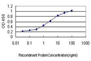 Detection limit for recombinant GST tagged ADRM1 is approximately 0. (ADRM1 antibody  (AA 18-407))