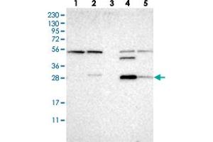 Western blot analysis of Lane 1: RT-4, Lane 2: U-251 MG, Lane 3: Human Plasma, Lane 4: Liver, Lane 5: Tonsil with CA13 polyclonal antibody  at 1:250-1:500 dilution.