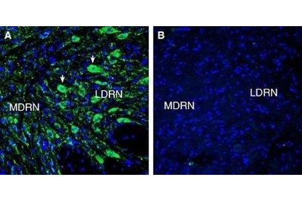 HTR7 antibody  (Extracellular, N-Term)