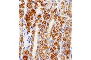 Immunohistochemistry (Paraffin-embedded Sections) (IHC (p)) image for anti-Epidermal Growth Factor Receptor (EGFR) (AA 1163-1191), (C-Term) antibody (ABIN1882237)
