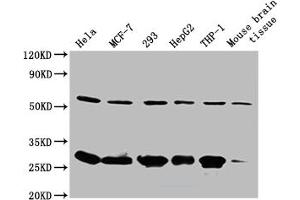 Western Blot Positive WB detected in: Mouse spleen tissue All lanes: RPL19 antibody at 2 μg/mL Secondary Goat polyclonal to rabbit IgG at 1/50000 dilution Predicted band size: 24 kDa Observed band size: 24 kDa (RPL19 antibody  (AA 79-196))