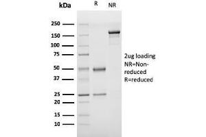 SDS-PAGE Analysis Purified vWF Recombinant Mouse Monoclonal Antibody (rVWF/1465). (Recombinant VWF antibody  (AA 1815-1939))