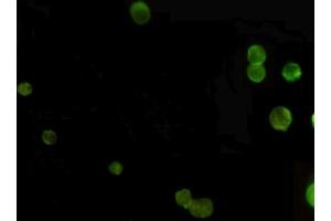 Immunocytochemistry (ICC) image for anti-alpha-Methylacyl-CoA Racemase (AMACR) (C-Term) antibody (ABIN6241165)