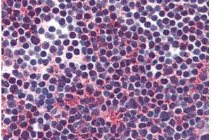 Anti-VIPR2 antibody  ABIN1049457 IHC staining of human thymus. (VIPR2 antibody  (Internal Region))