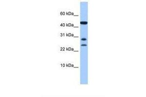 Image no. 1 for anti-Chromosome 20 Open Reading Frame 141 (C20orf141) (AA 91-140) antibody (ABIN6739362) (C20orf141 antibody  (AA 91-140))