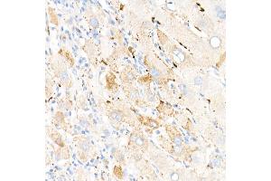 Immunohistochemistry of paraffin-embedded human liver using Perilipin-2 antibody (ABIN7269220) at dilution of 1:1600 (40x lens). (ADRP antibody)