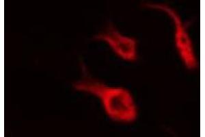 ABIN6266917 staining HeLa by IF/ICC. (Serotonin Receptor 5A antibody  (Internal Region))