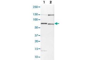 Western blot analysis of Lane 1: NIH-3T3 cell lysate (Mouse embryonic fibroblast cells); Lane 2: NBT-II cell lysate (Rat Wistar bladder tumour cells) with BIRC3 polyclonal antibody  at 1:100-1:250 dilution.