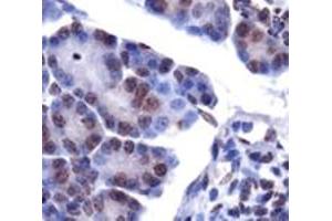 Staining of LPIN1 on mouse pancreas using LPIN1 polyclonal antibody .