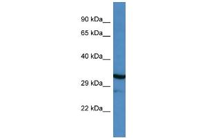 Western Blotting (WB) image for anti-Myocilin (MYOC) (N-Term) antibody (ABIN2774268) (MYOC antibody  (N-Term))