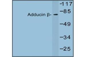 Western blot analysis of Beta-Adducin Antibody in extracts from 293 cells. (ADD2 antibody)