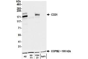 Western Blotting (WB) image for anti-Complement Component (3d/Epstein Barr Virus) Receptor 2 (CR2) (C-Term) antibody (ABIN7795815) (Recombinant CD21 antibody  (C-Term))