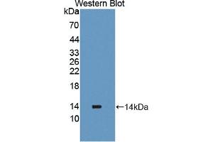 Detection of Recombinant PLOD2, Human using Polyclonal Antibody to Procollagen Lysine-2-Oxoglutarate-5-Dioxygenase 2 (PLOD2) (PLOD2 antibody  (AA 644-737))