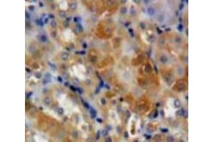 Used in DAB staining on fromalin fixed paraffin-embedded Kidney tissue (GAS2 antibody  (AA 64-267))