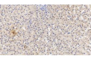 Detection of VF in Human Liver Tissue using Monoclonal Antibody to Visfatin (VF) (NAMPT antibody  (AA 1-491))