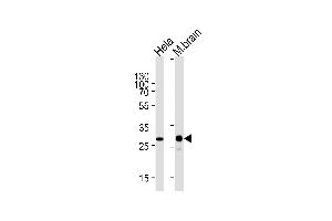 Western blot analysis of lysates from Hela cell line and mouse brain tissue lysate (from left to right) using CDK5 Antibody (ABIN1944859 and ABIN2843645).