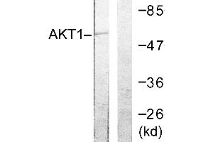 Immunohistochemistry analysis of paraffin-embedded human ovary tissue using Akt (Ab-72) antibody. (AKT1 antibody  (Thr72))