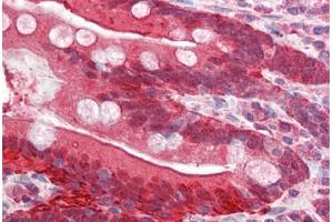 Human Small Intestine (formalin-fixed, paraffin-embedded) stained with FABP2 antibody ABIN337124 at 2. (FABP2 antibody  (AA 121-132))